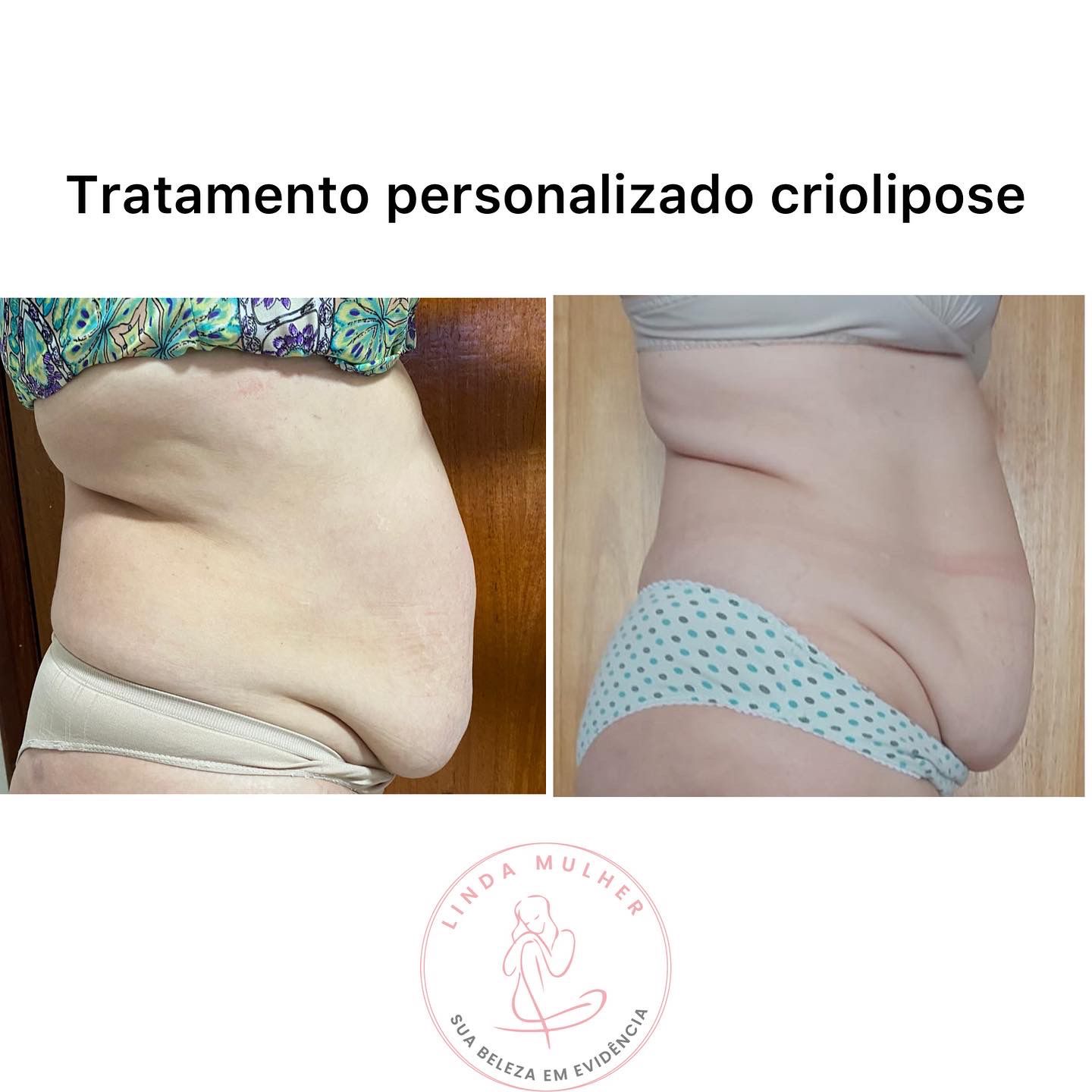 Centro Estetico Linda Mulher Remodelação Corporal Shape Slim Detox #16